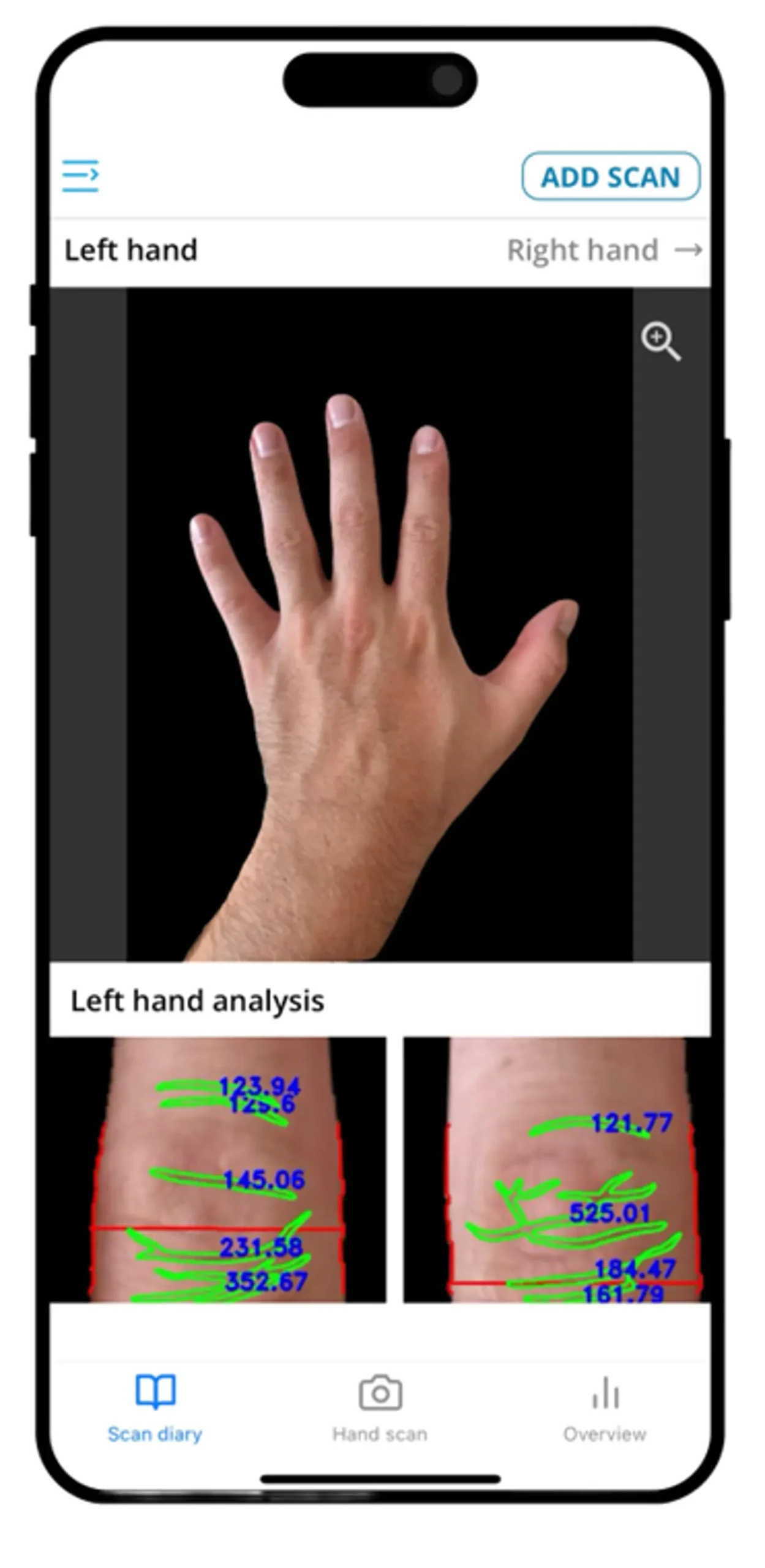 Screenshot of the DETECTRA app on a mobile phone